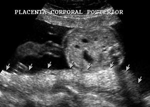 placenta