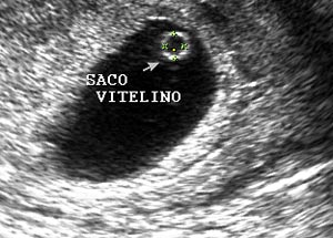 Saco Vitelino