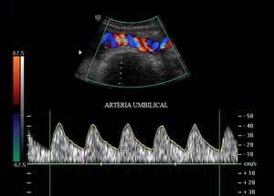 arteria